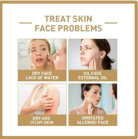 Rice Face Toner - Hydrating & Moisturizing - Evallys.com