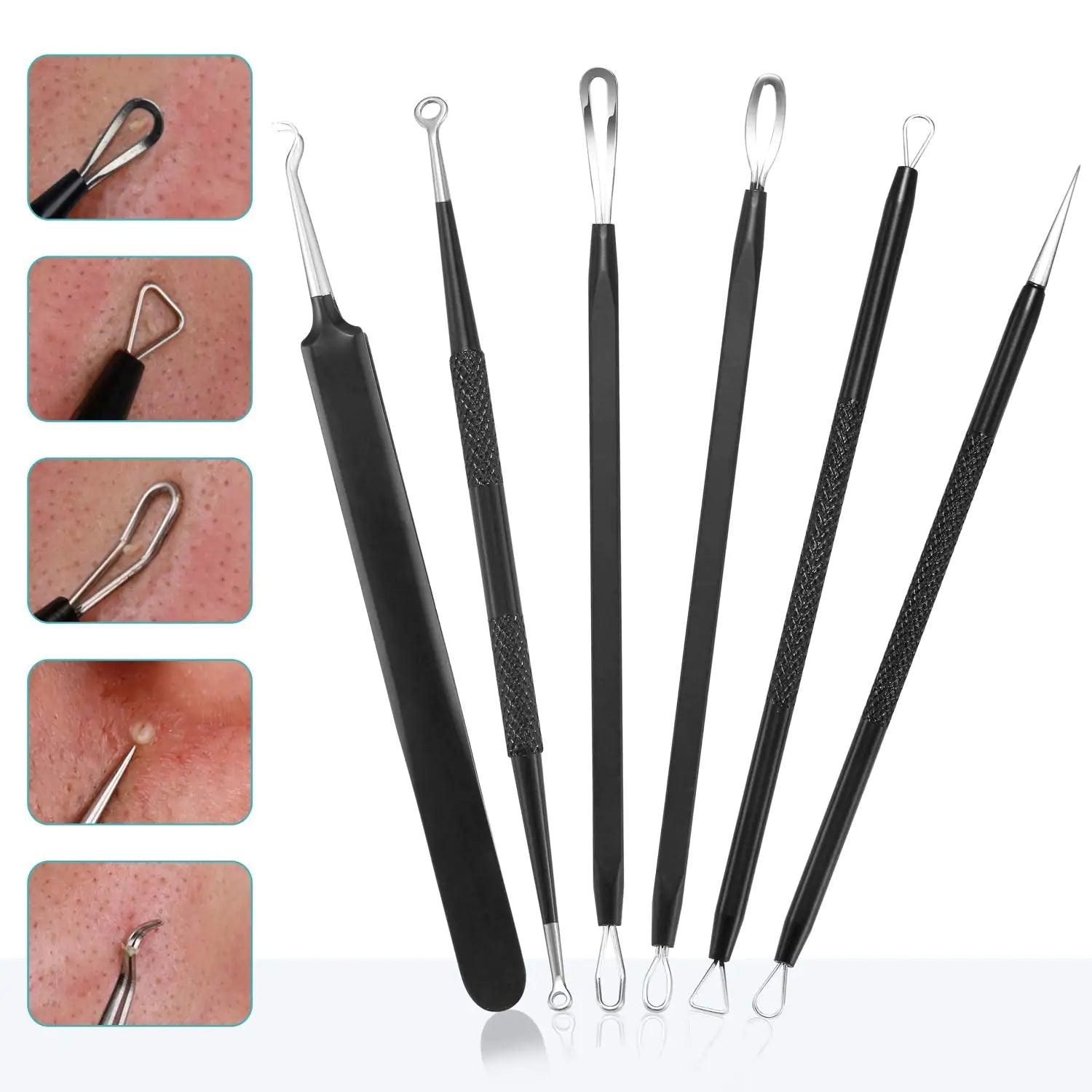 Blackhead Remover Pimple Popper Tool Kit - (6 Piece Kit) - Professional Stainless Pimples Comedone Extractor Removal Tool - Evallys.com # #