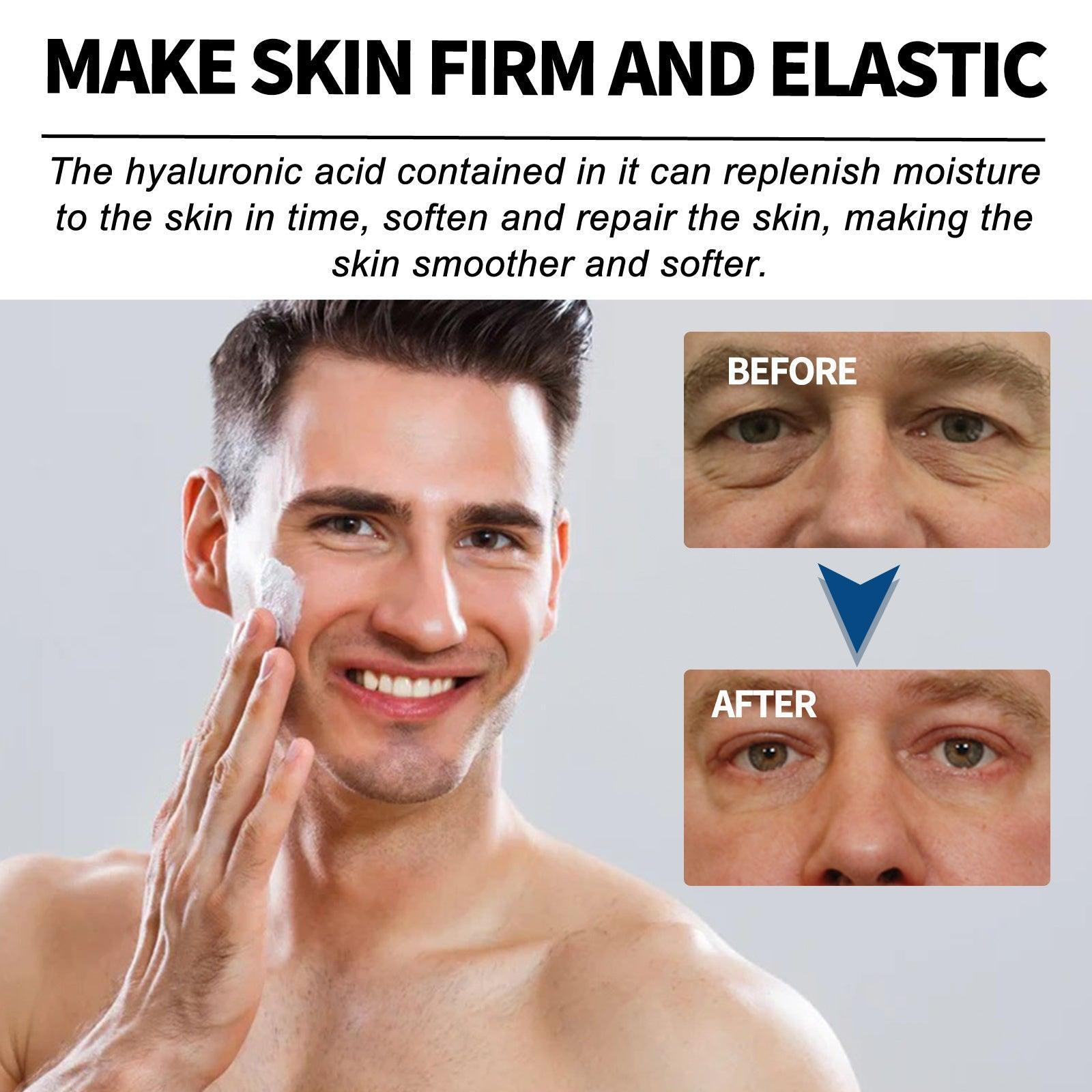 East Moon Men's Anti-wrinkle Cream To Lighten The Fine Lines And Wrinkles Tightening Facial Skin Hydration Anti-aging Cream - Evallys.com # #