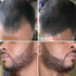 Beard Pen Filler for Men - Barber Styling Grooming Pencil - Waterproof Proof, Sweat Proof, Long Lasting Solution with Natural Finish - Cover Beard and Scalp Patches in Seconds - Dark Brown 2 Pack 1 Count (Pack of 2) - Evallys.com # #