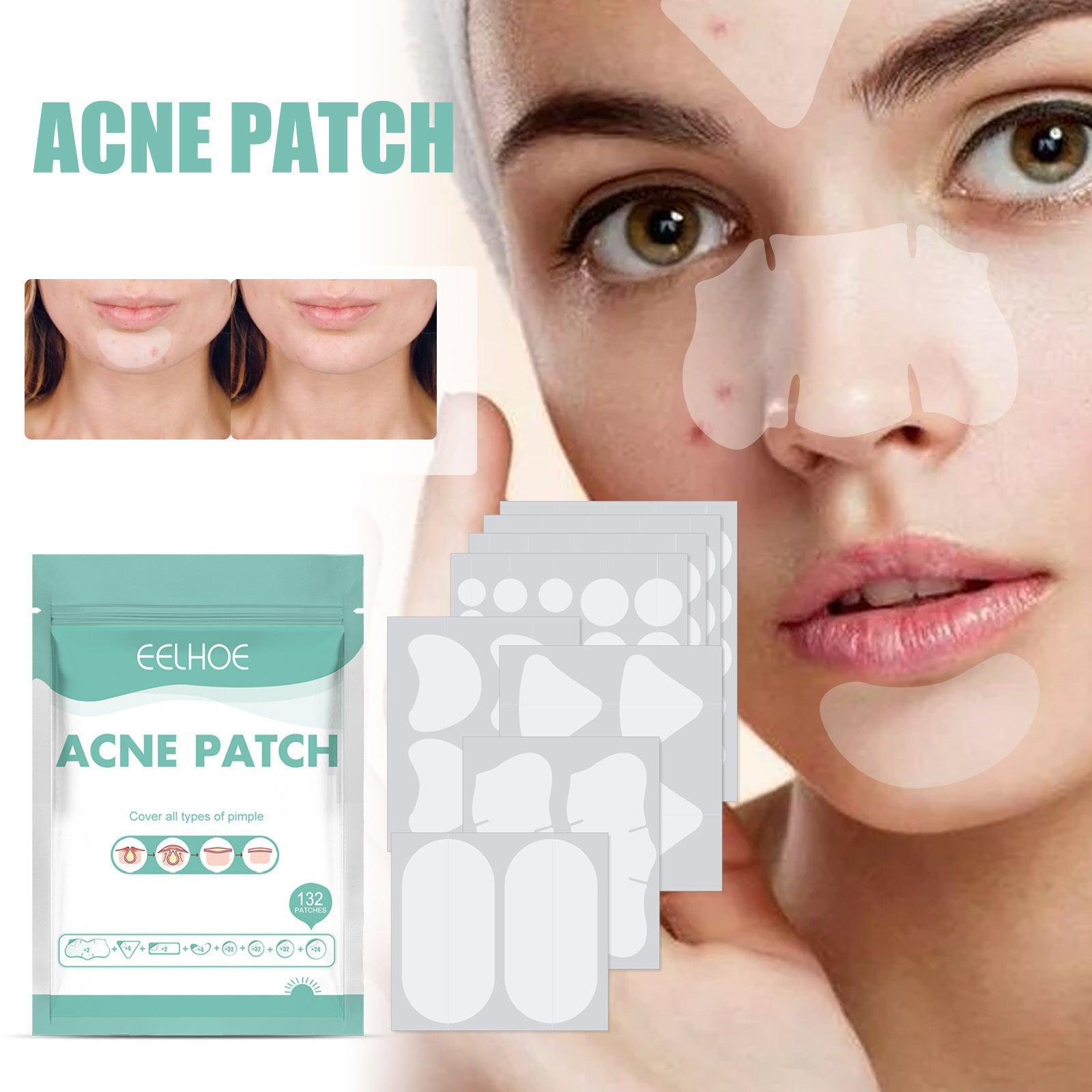 EELHOE Acne Relief Mask Patch Is A Gentle, Non-irritating Acne Mask That Helps To Reduce Acne Marks And Heal Acne. - Evallys.com # #