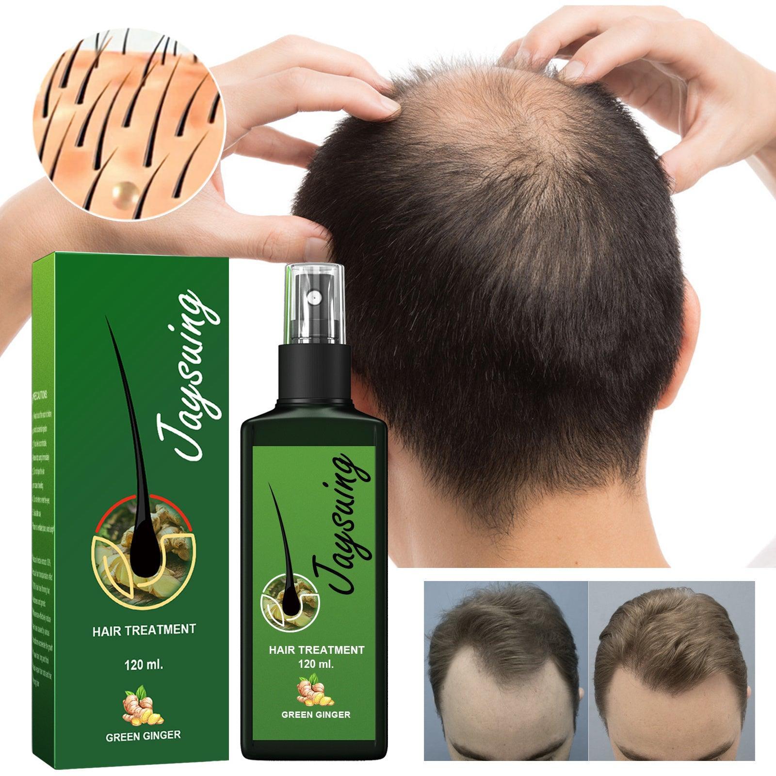 Jaysuing Hair Treatment, Strengthens Hair, Nourishes Root Growth And Thickens Scalp Massage Nutrient Solution - Evallys.com # #