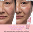 Glow Recipe PHA + BHA Face Toner - Korean Skin Care Toner, Pore Minimizer & Facial Exfoliator for Glass Skin - Tightening & Hydrating Skincare with Hyaluronic Acid & Watermelon (150ml) 5 Fl Oz (Pack of 1) Full Size - Evallys.com # #