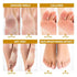 Lavinso Honey Feet Peeling Mask for Dry Cracked Feet - 4 Pack - with Kojic Acid Skin Brightening Effect - Exfoliating Dead Skin and Calluses - Foot Peel Mask for Baby Soft Feet Honey and Turmeric 1 Count (Pack of 4) - Evallys.com # #