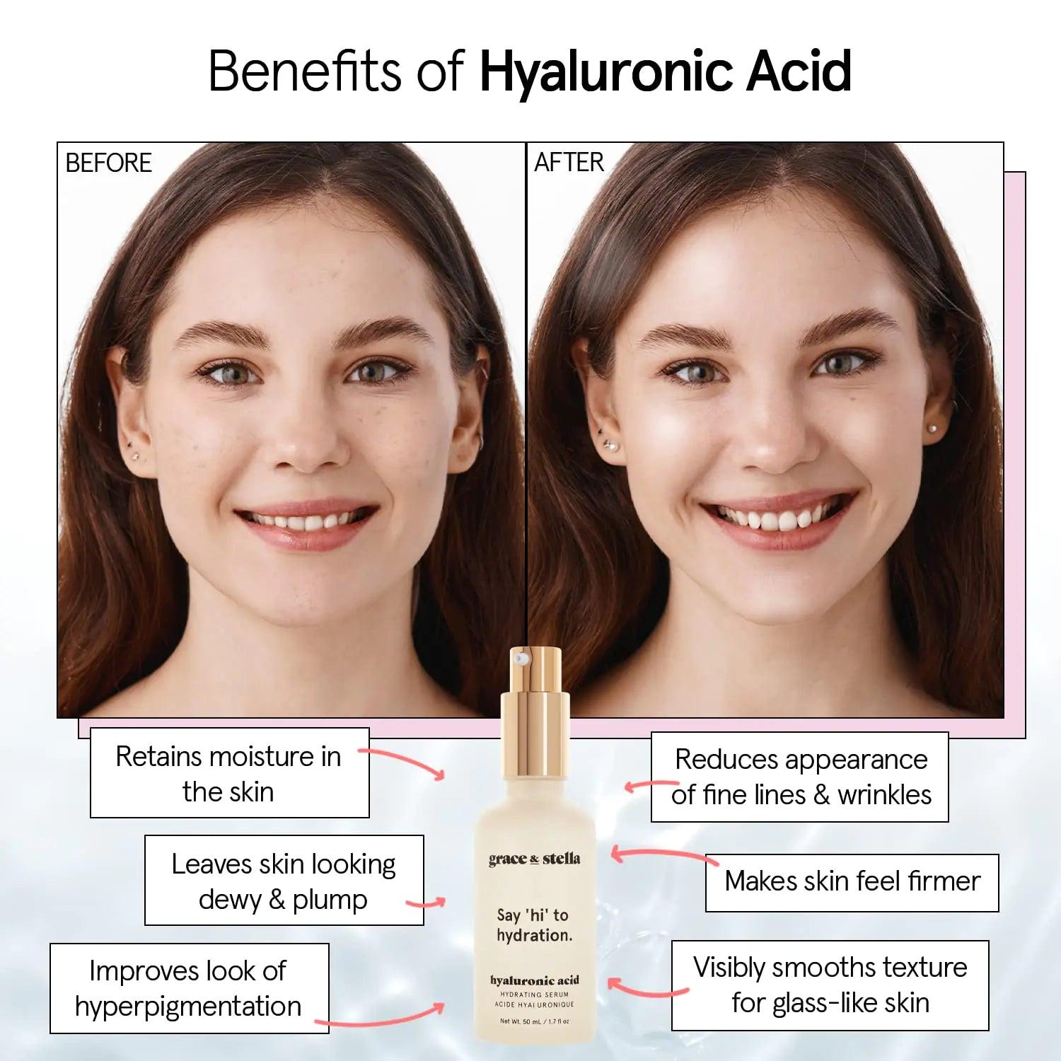 Grace & Stella Hyaluronic Acid Serum for Face - 50ml, Anti-Aging Serum with Hydrating and Brightening Properties, Vegan and Paraben-Free 50ml Pump - Evallys.com # #