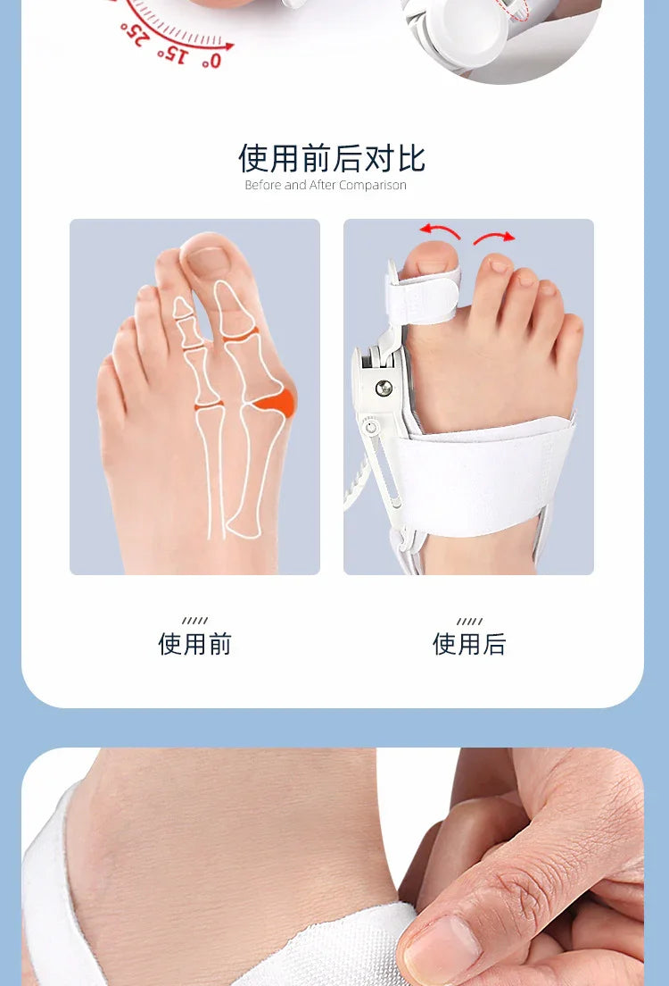 Hallux Valgus Corrector Bunions For Toes Corrector Foot Finger Separator Toe Separator Foot Care Bunion Corrector - Evallys.com