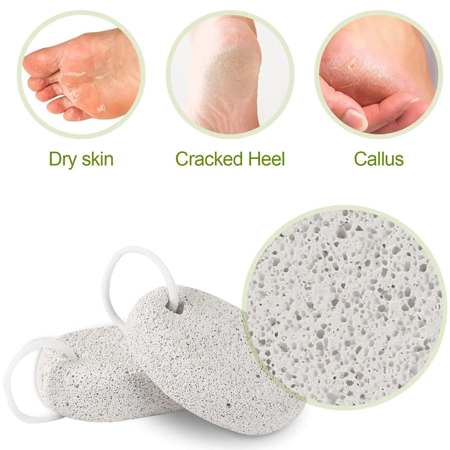 2PCS Natural Pumice Stone, Asqraqo Lava Pedicure Tools Hard Skin Callus Remover for Feet and Hands - Foot File Exfoliation to Remove Dead Skin, and Callusess - Evallys.com # #