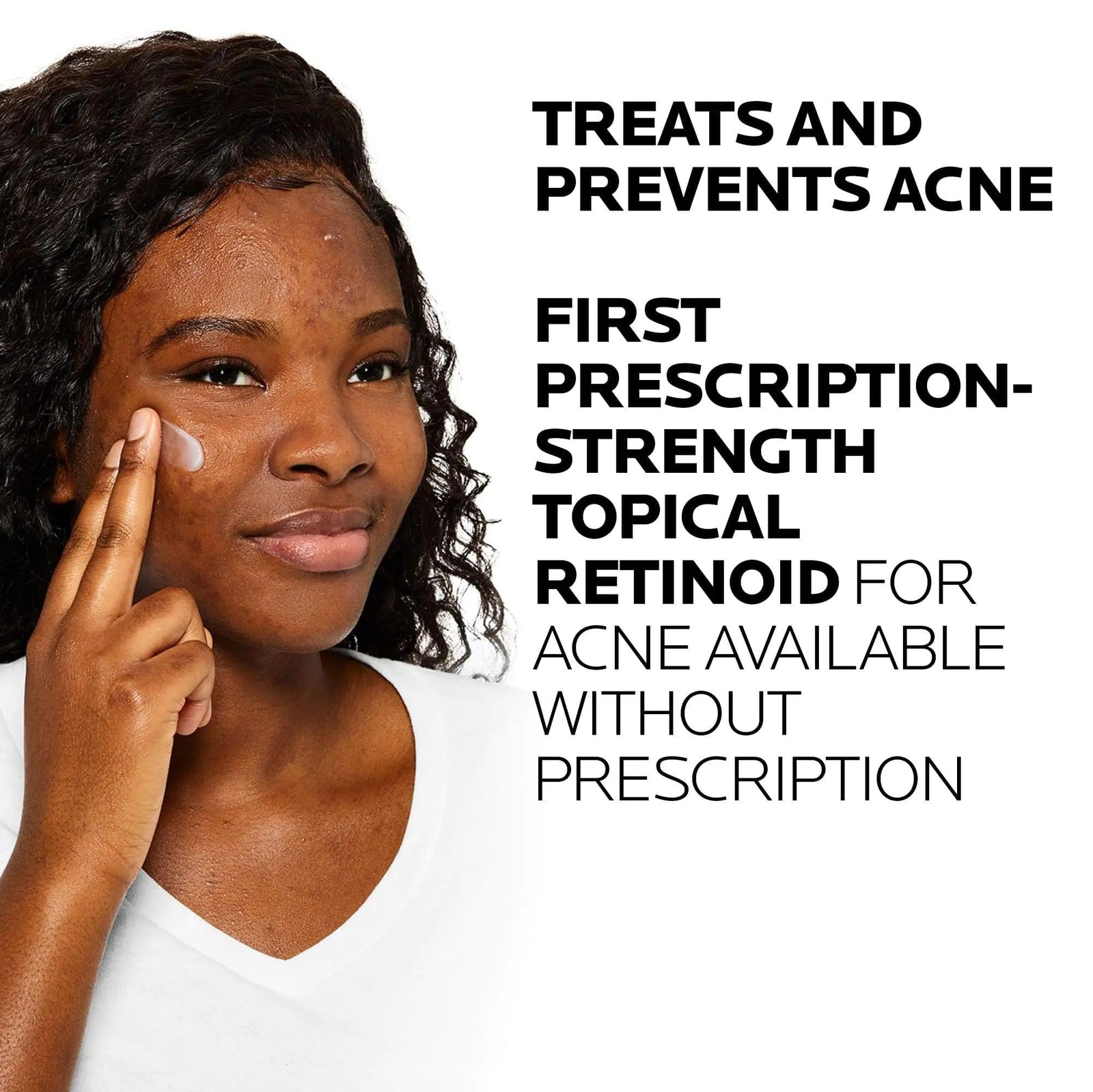 La Roche-Posay Effaclar Adapalene Gel 0.1% Acne Treatment | Retinoid Acne Cream | Acne Medication | Acne Gel For Blackheads & Whiteheads | Oil Free | Helps Clear And Prevent Acne & Clogged Pores - Evallys.com # #