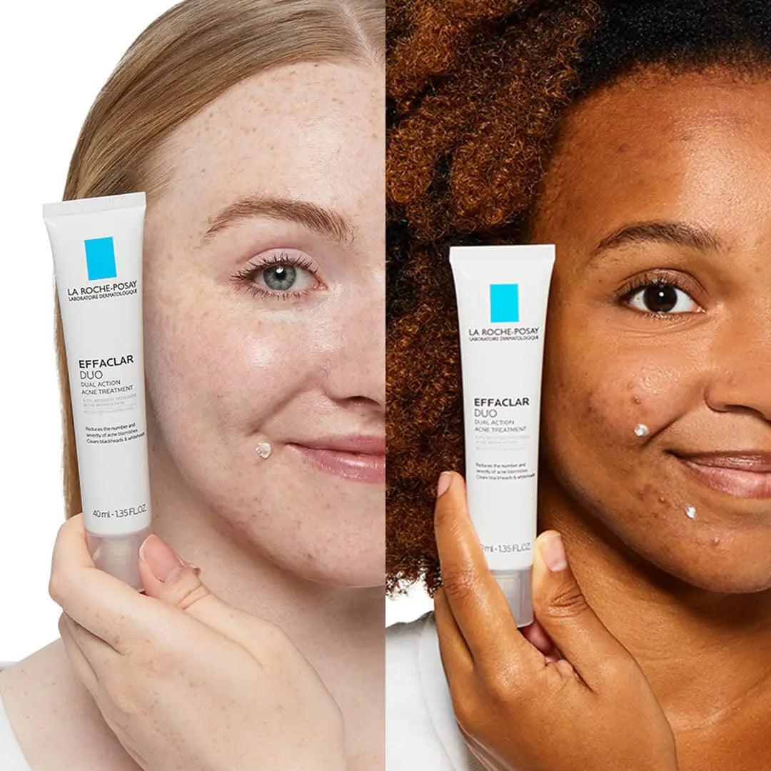 La Roche-Posay Effaclar Duo Dual Action Acne Spot Treatment Cream with Benzoyl Peroxide Acne Treatment for Acne and Blackheads, Lightweight Sheerness, Safe For Sensitive Skin 0.7 Fl Oz (Pack of 1) - Evallys.com # #