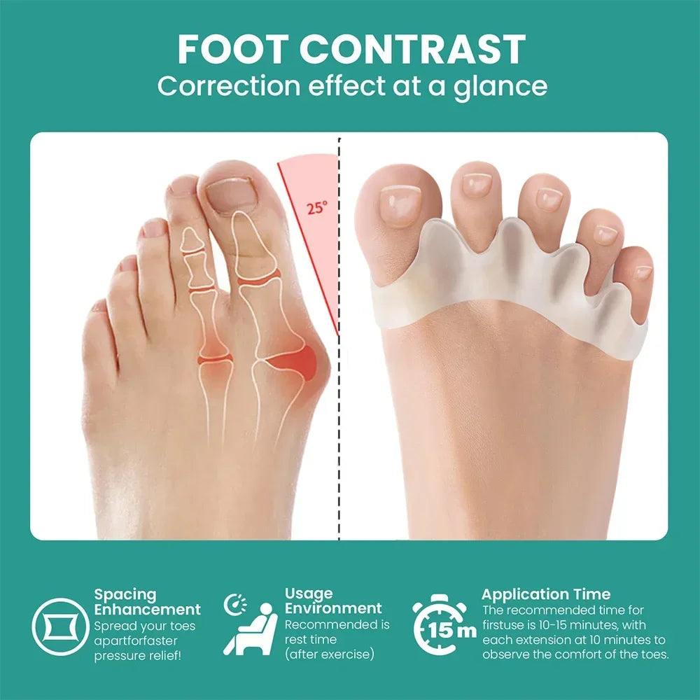 1 Pair Silicone Toe Separator, Bunion Corrector,Hammer Toe Corrector, Soft Silicone Material for Toe Separation Foot Care Tool - Evallys.com
