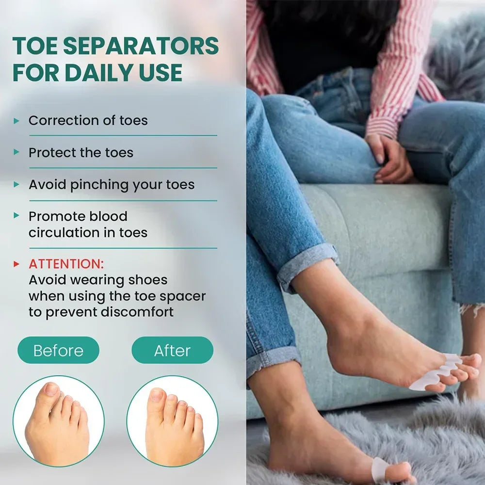 1 Pair Silicone Toe Separator, Bunion Corrector,Hammer Toe Corrector, Soft Silicone Material for Toe Separation Foot Care Tool - Evallys.com