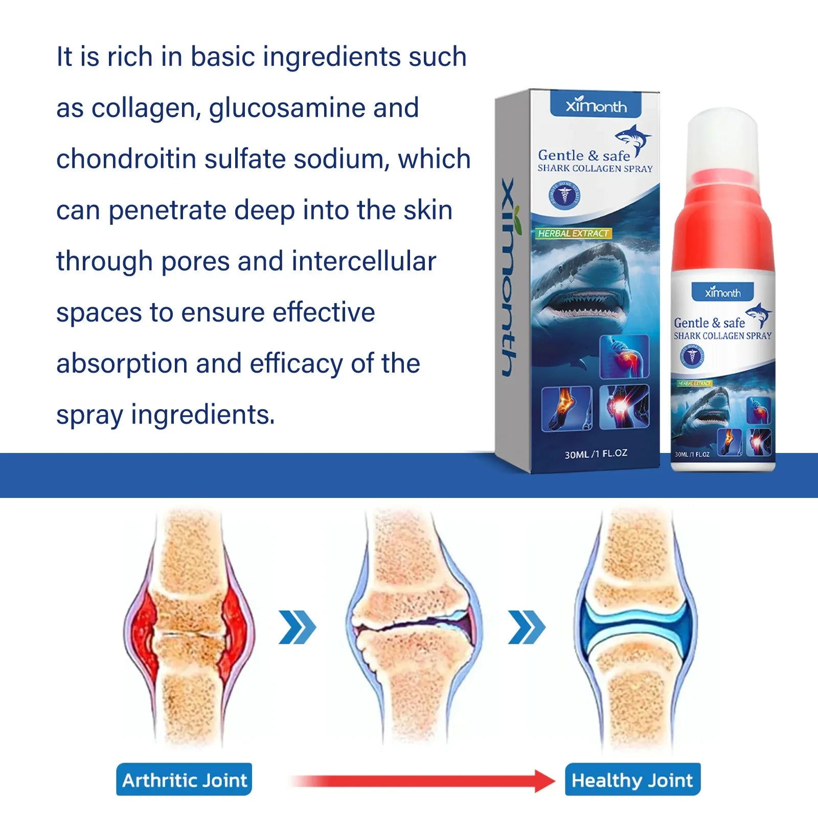30ml Anti Pain Ointment Knee Relief Spray Relieve Knee Arthritis Soothes Health Treatment Pain Joint Care Body Foot 무지외반증교정기 - Evallys.com