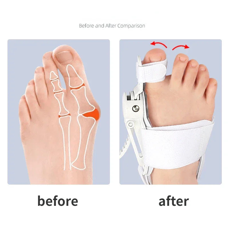 Hallux Valgus Corrector Bunions For Toes Corrector Foot Finger Separator Toe Separator Foot Care Bunion Corrector - Evallys.com