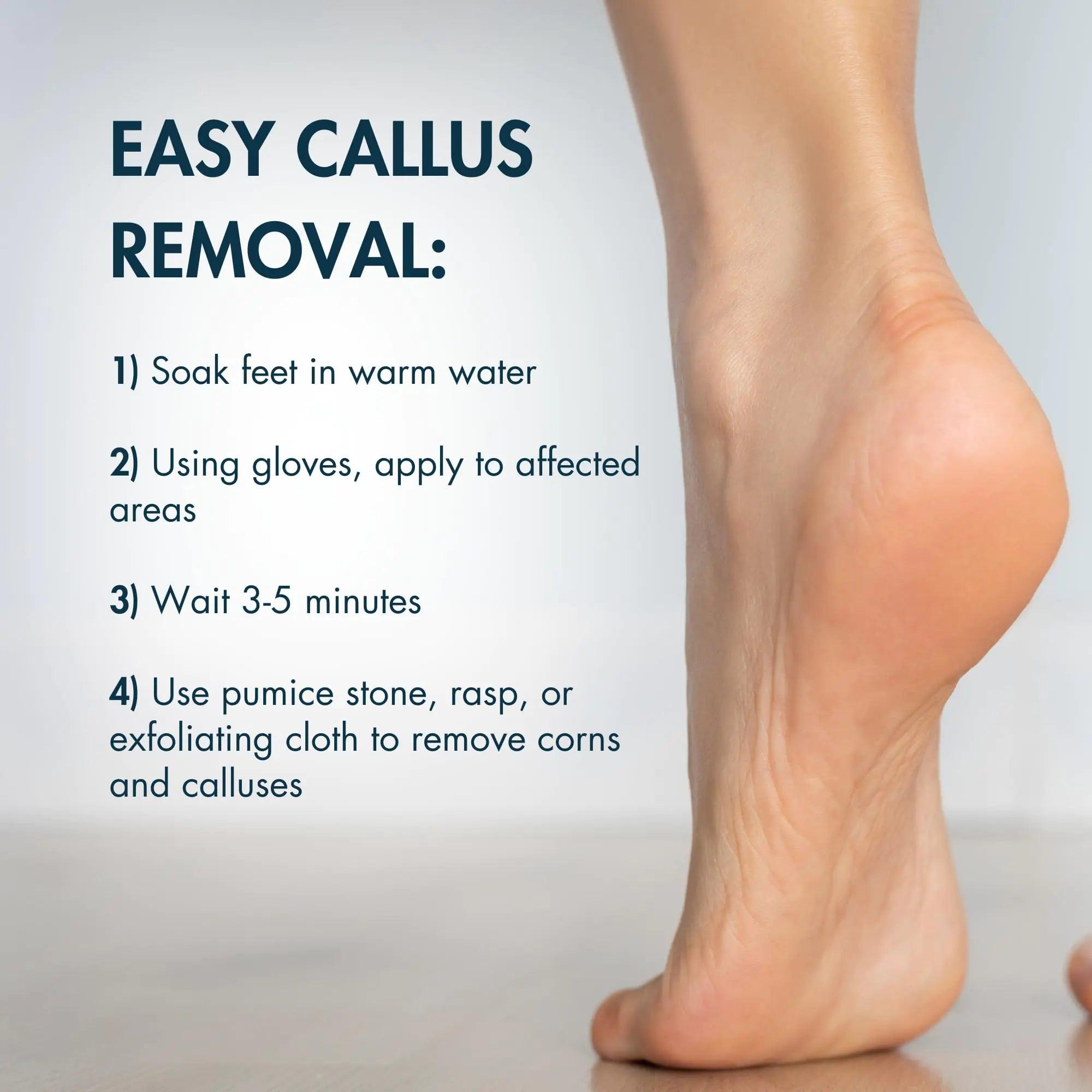 DeEnti Callus Remover Gel, Extra Strength Foot Callus Remover, 8oz Salon Grade Home Pedicure Supplies for Rough, Dry, Cracked Skin, Heavy Duty Callus Remover for Feet, Unscented - Evallys.com # #