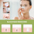 LANBENA Blackhead Remover - Peel Off Mask for Nose & Face, Blackhead Removal Kit 1.05oz - Evallys.com # #