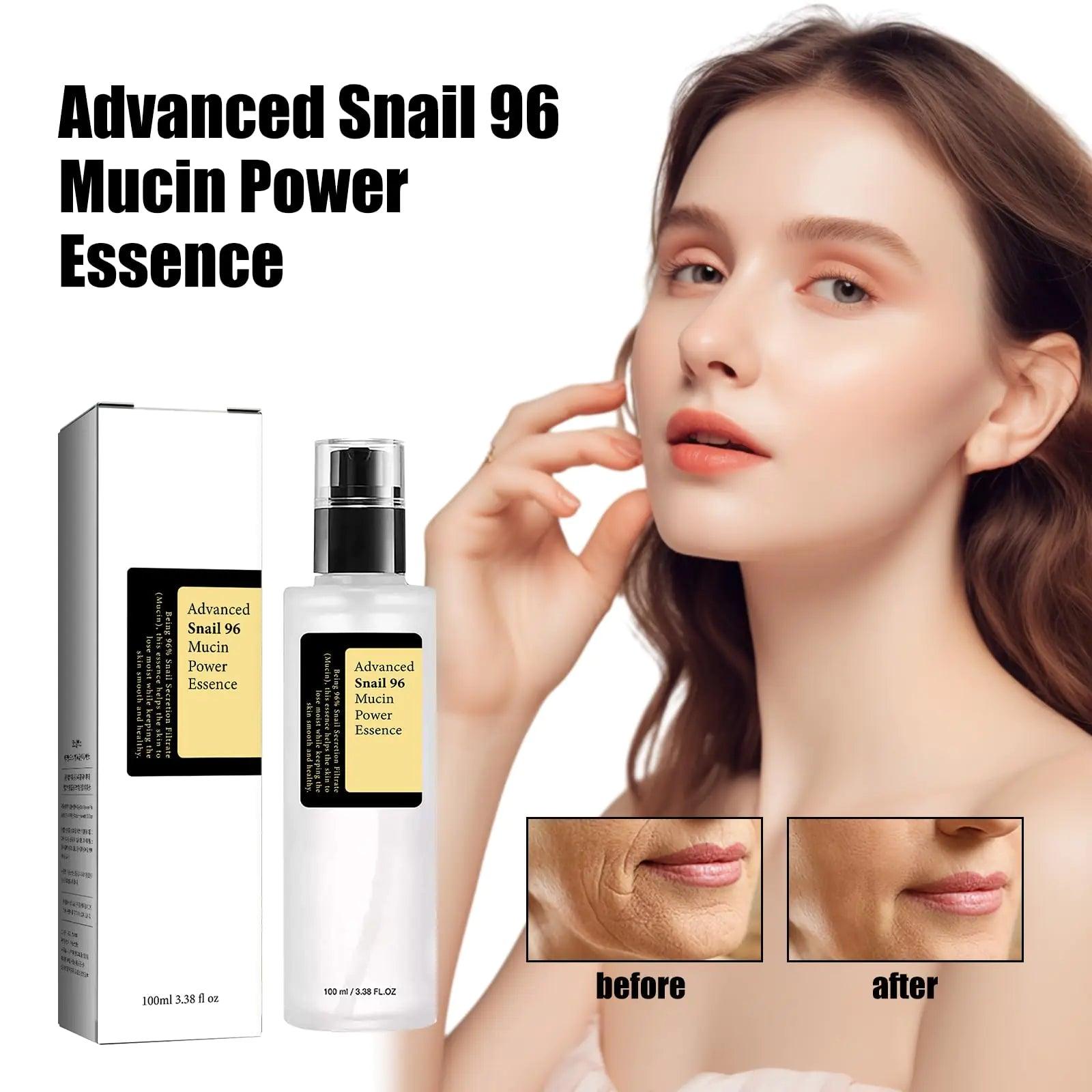 Advanced Snail Mucin 96% Power Repairing Essence, Snail Mucin 96% - Anti-Aging Serum, With Snail Secretion Filtrate For Dull And Damaged Skin, Anti-Aging & Discoloration Correcting(100ml/2 PCS) 2 PCS - Evallys.com # #