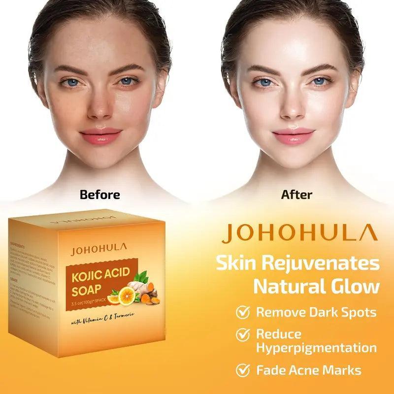 Johohula Turmeric Kojic Acid Soap, Dark Spot Corrector Soap Bars with Vitamin C, Retinol, Collagen, Turmeric - Smooth for Face and Body, Firm and Smooth Skin - 3 X 100G Bars - Evallys.com # #