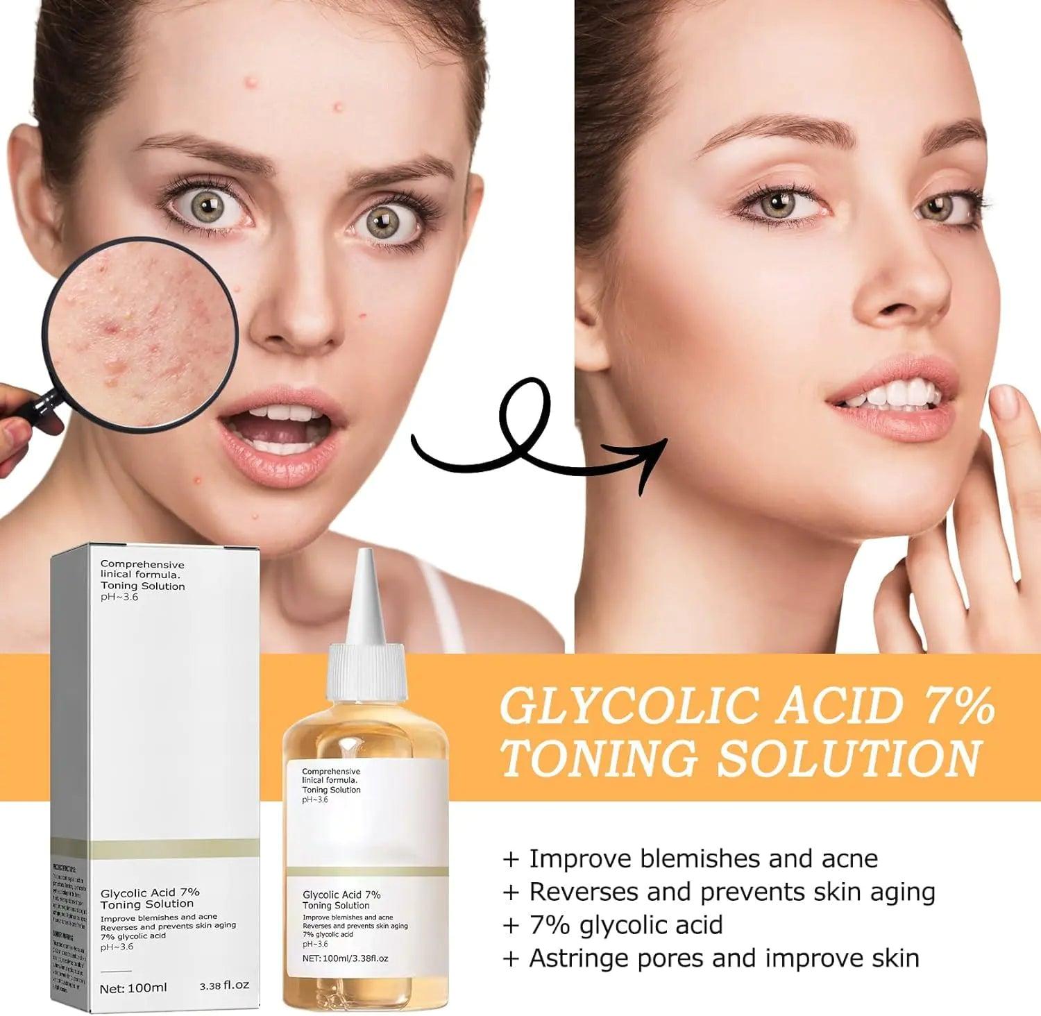 240ML Glycolic Acid 7% Toner,Glycolic Sour 7% Toning,KeepThe Skin Moist,Exfoliate, Exfoliating Serum for Face,Hydrates and Reduces Skin Blemishes (8.12 f.oz) - Evallys.com # #