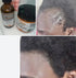 Rosemary and Fenugreek Hair Growth Butter Haircare Herbal, Hair Growth Balm, Alopecia Oil, Scalp Dandruff Moisturize - Evallys.com # #