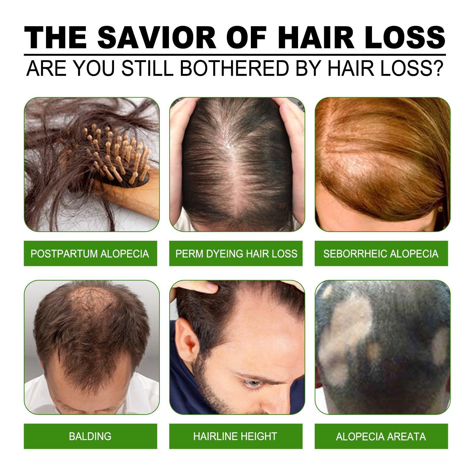 Jaysuing Hair Treatment, Strengthens Hair, Nourishes Root Growth And Thickens Scalp Massage Nutrient Solution - Evallys.com # #