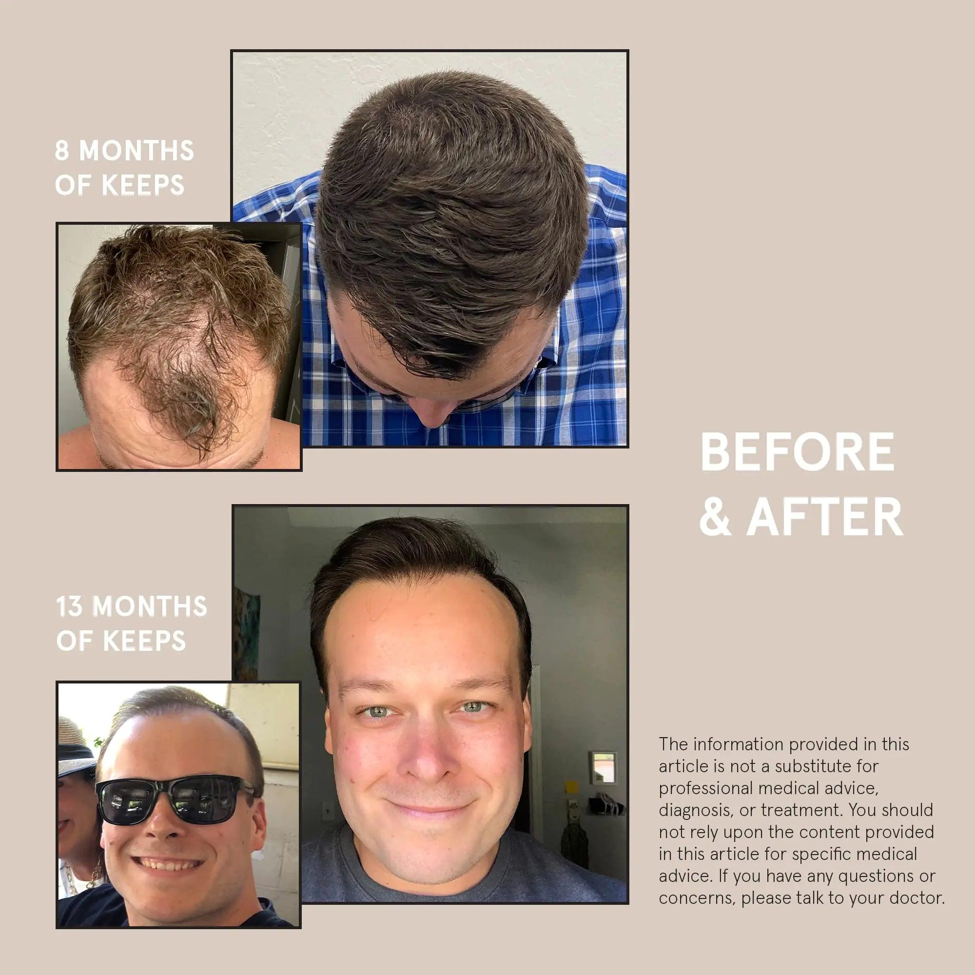 Keeps Hair Growth Shampoo and Conditioner Set - Treatment for Thinning Hair and Hair Regrowth - Men's Hair Products Infused with Biotin, Caffeine, & Saw Palmetto Shampoo & Conditioner Set - Evallys.com # #