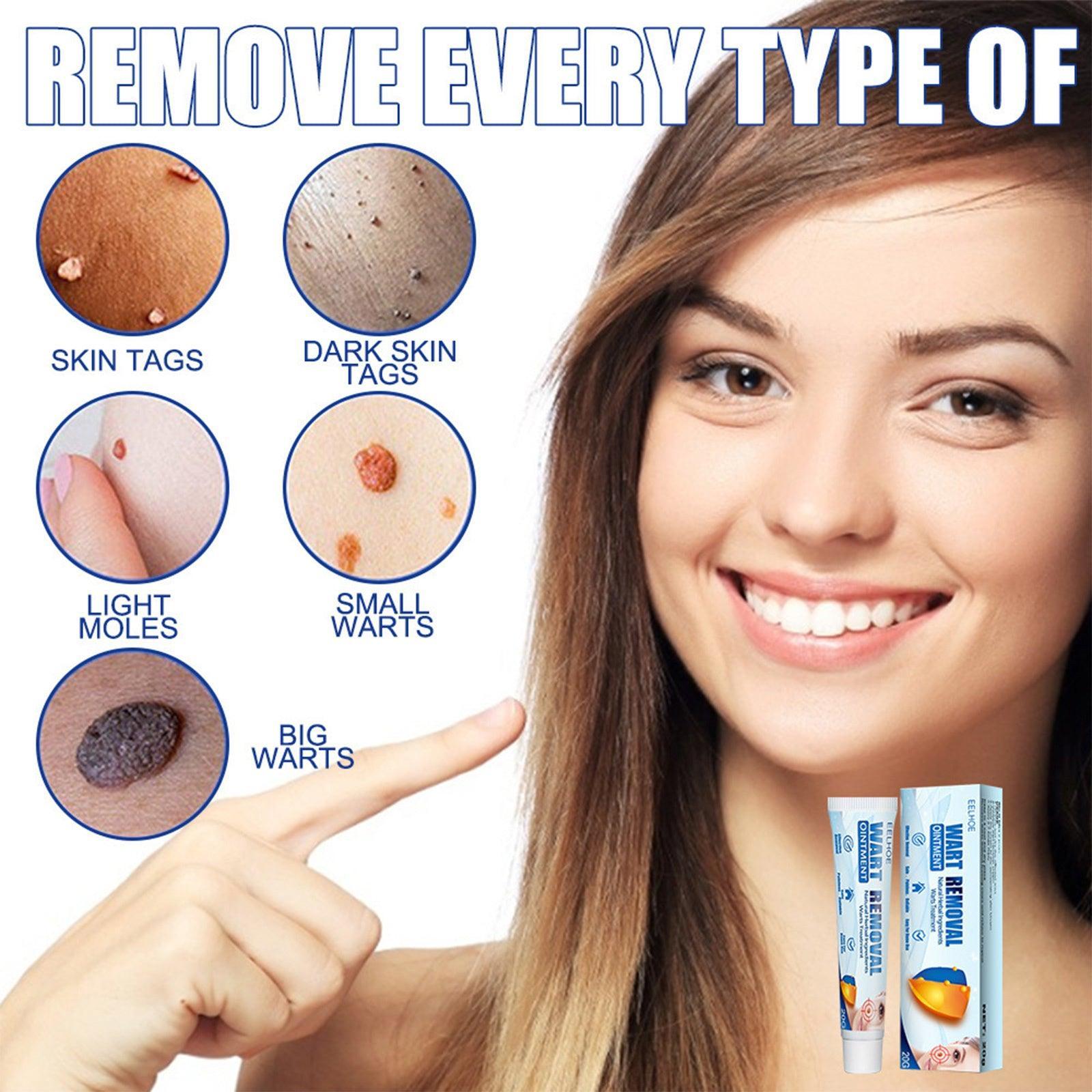 EELHOE Fragrance Removing Cream, Cleansing Skin Repair Care Body Face Removal Face Label Keyu Cream - Evallys.com # #