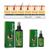 Jaysuing Hair Treatment, Strengthens Hair, Nourishes Root Growth And Thickens Scalp Massage Nutrient Solution - Evallys.com # #