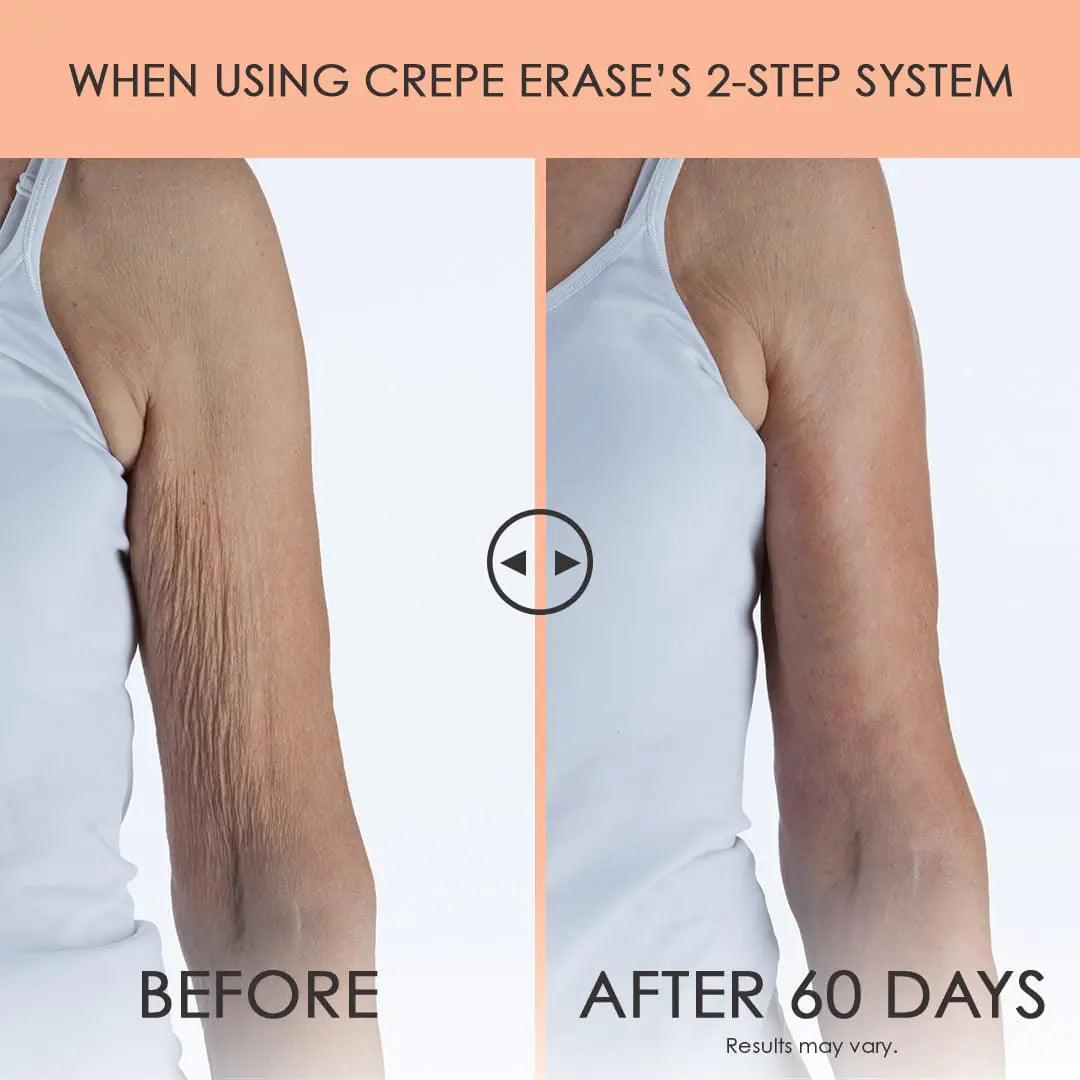 Crepe Erase Advanced Body Repair Treatment, Anti-Aging Wrinkle Cream for Face and Body, Support Skins Natural Elastin & Collagen Production - 10oz Citrus - Evallys.com # #