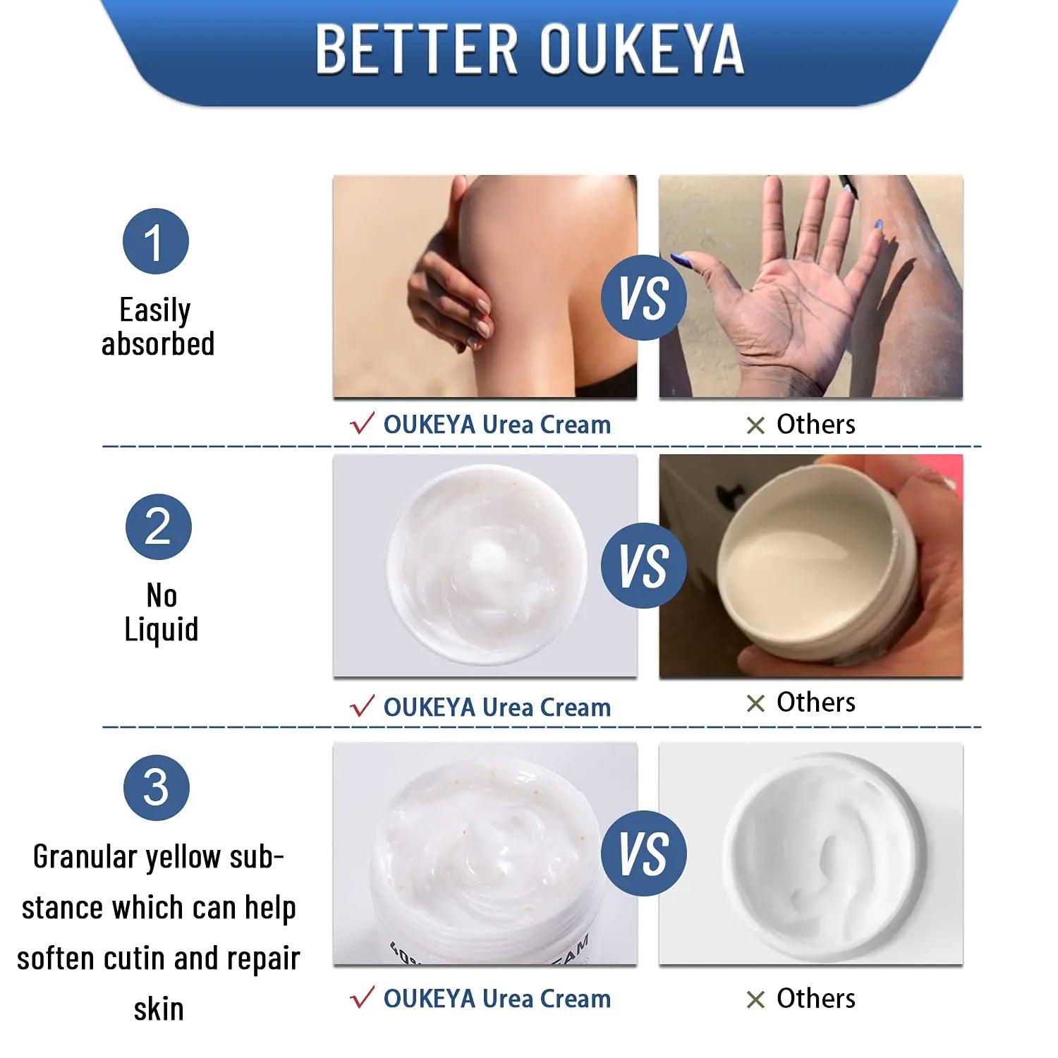 Urea Cream 40 Percent, Urea Foot & Hand Cream for Dry Cracked, 40 per Urea Lotion for Feet Maximum Strength (4 Packs) 5.29 Ounce (Pack of 4) - Evallys.com # #