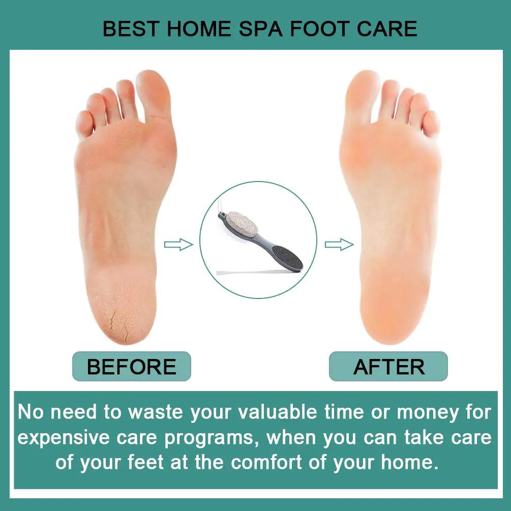 CAREHOOD Foot File Callus Remover - Multi Purpose 4 in 1 Feet Pedicure Tools with Foot Scrubber, Pumice Stone, Foot Rasp and Sand Paper for Home Foot Care (Grey Pedicure Foot File) Grey Pedicure Foot File - Evallys.com # #