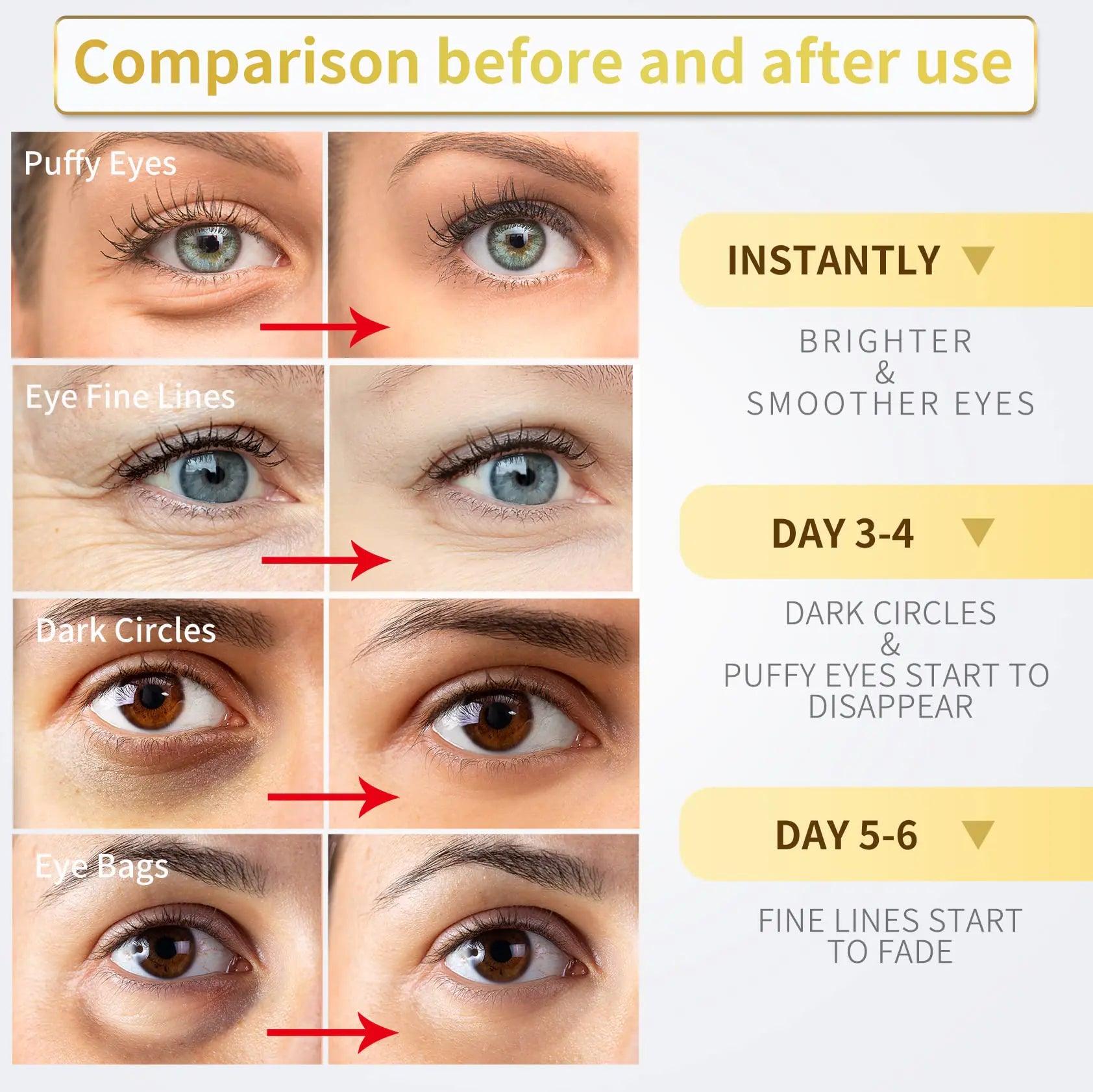 Under Eye Patches - 60 Pcs - 24K Gold Eye Mask- Puffy Eyes & Dark Circles Treatments,Reduce Under Eye Bags and Smooth Wrinkles,Eye Skin Care Pads With Collagen,Hyaluronic Acid & Castor Oil - Evallys.com # #