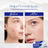 A313 Retinol Pommade Anti Aging Night Cream , The pore cleansing skin cream a313 - Evallys.com # #